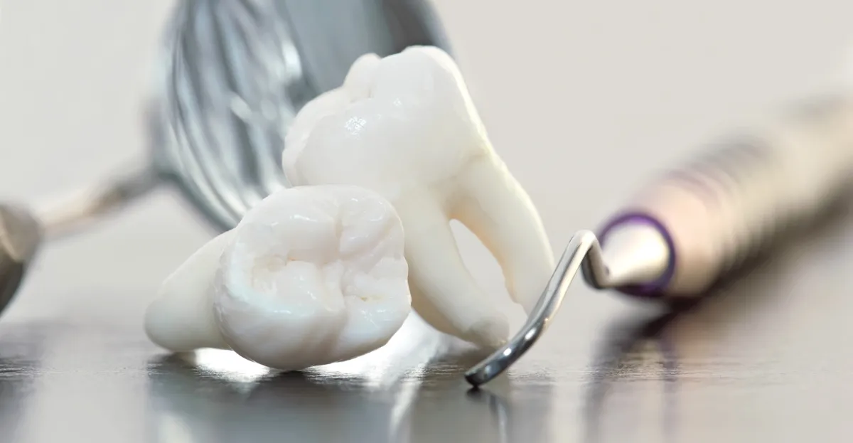 Everything You Need to Know About Wisdom Teeth Extractions