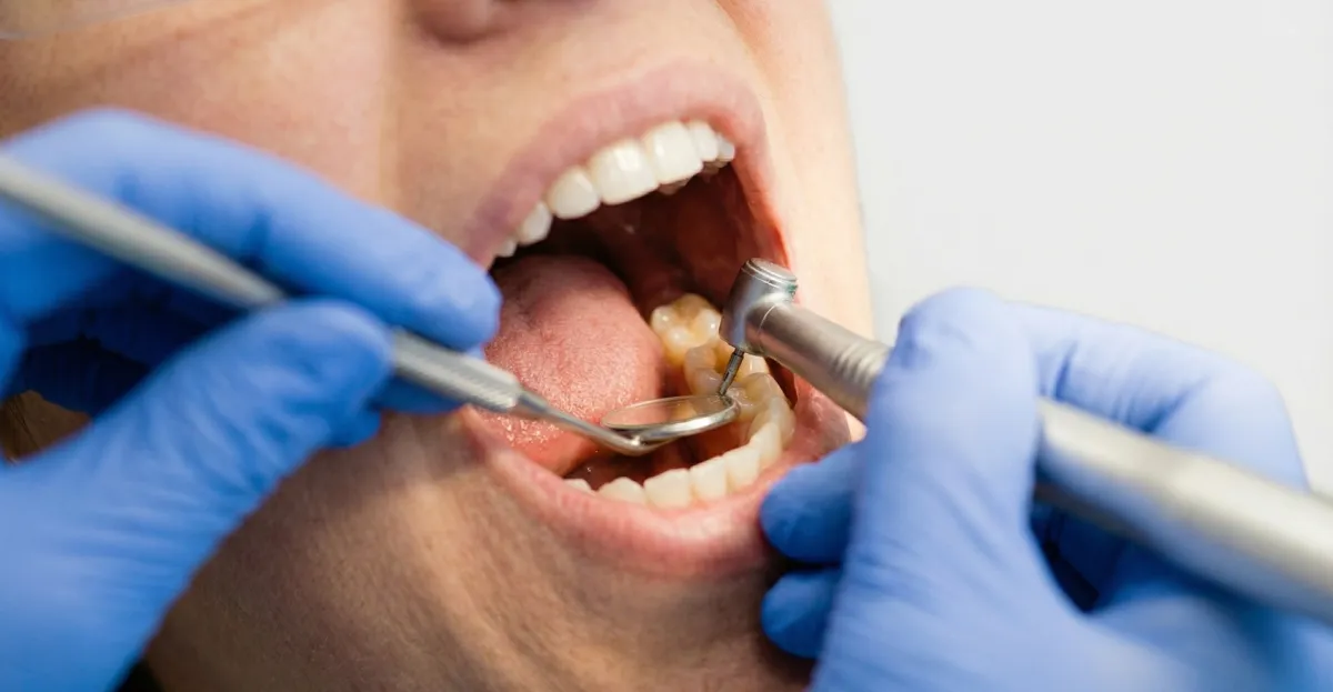 How Do I Know If I Have a Cavity?