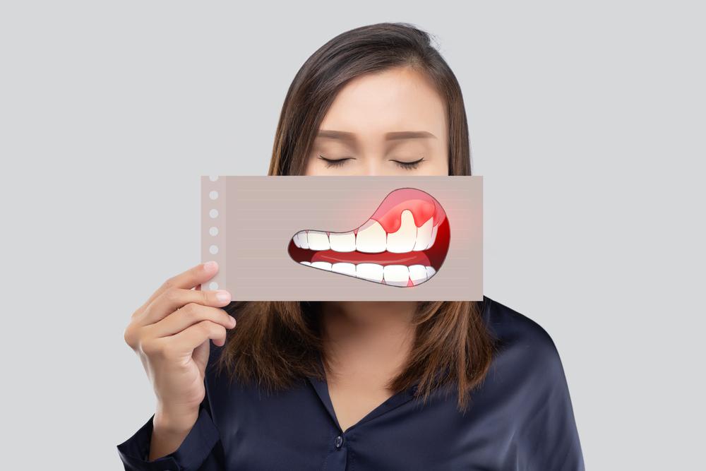 Gingivitis vs. Periodontitis: What’s the Difference?