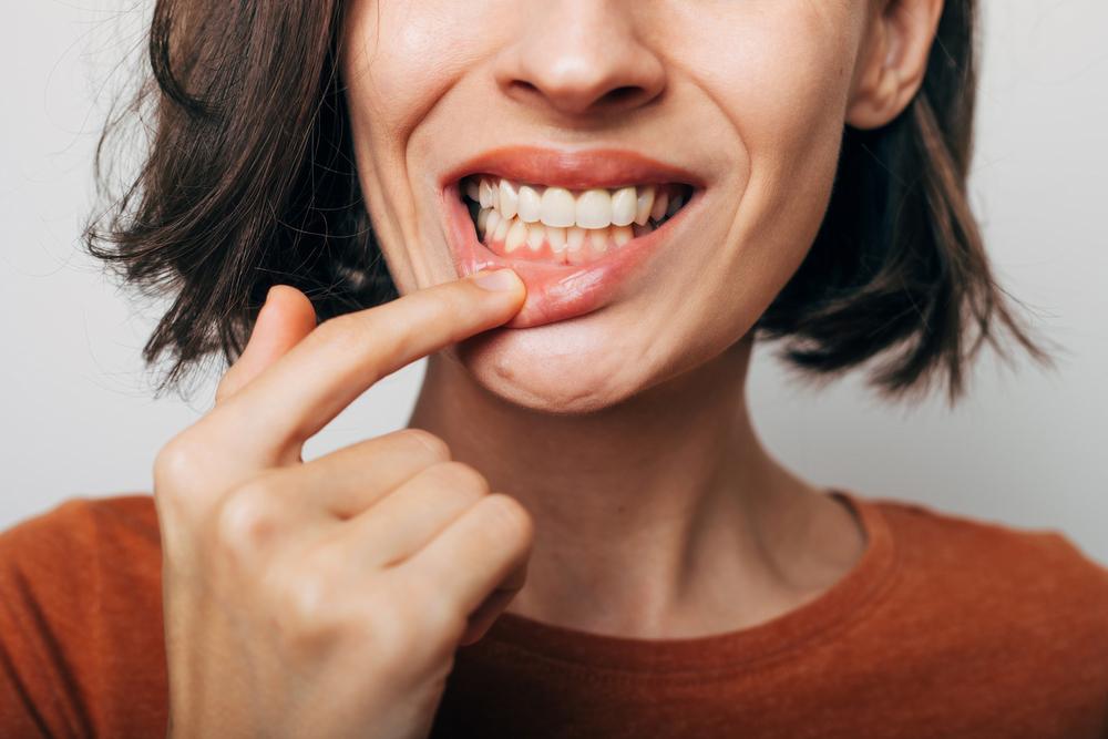 Celebrating National Gum Care Month!