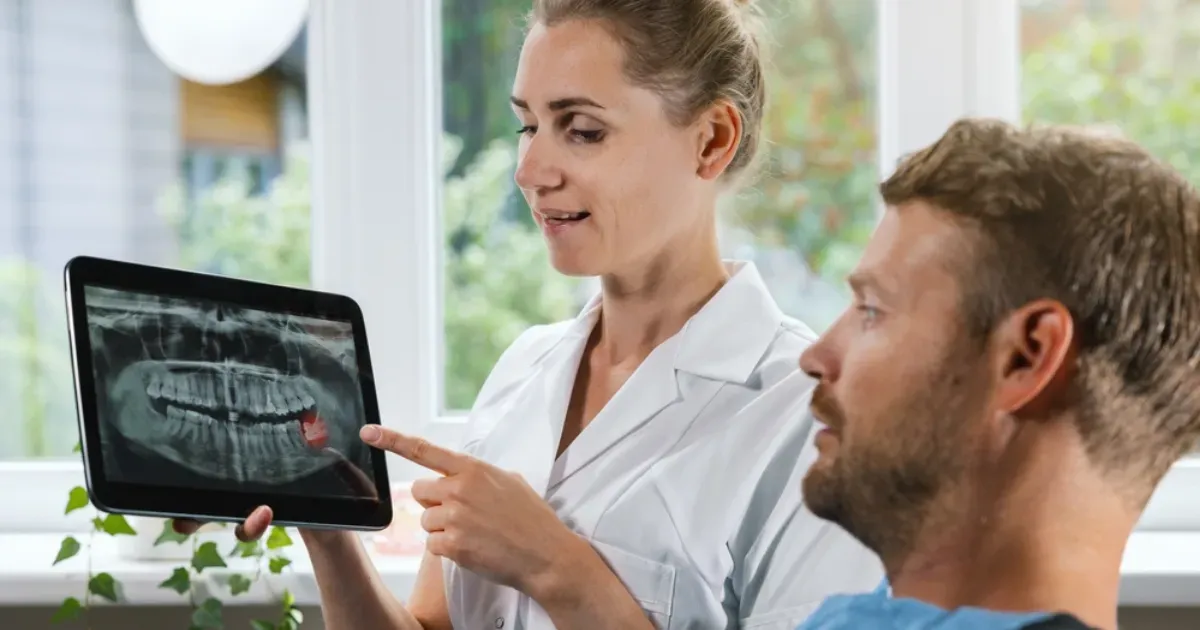 Wisdom Teeth Removal in Sunnyvale