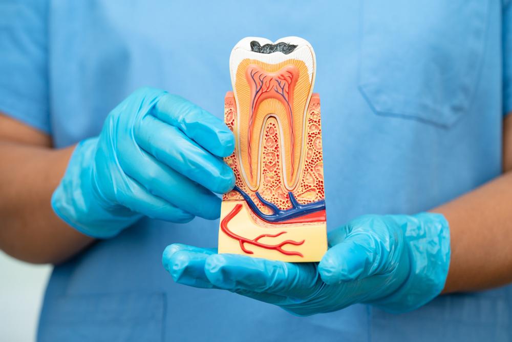Your Sunnyvale Guide to Emergency Root Canals
